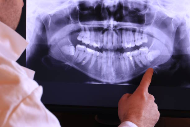 Best Weekend Emergency Dental Services in Lynwood, IL