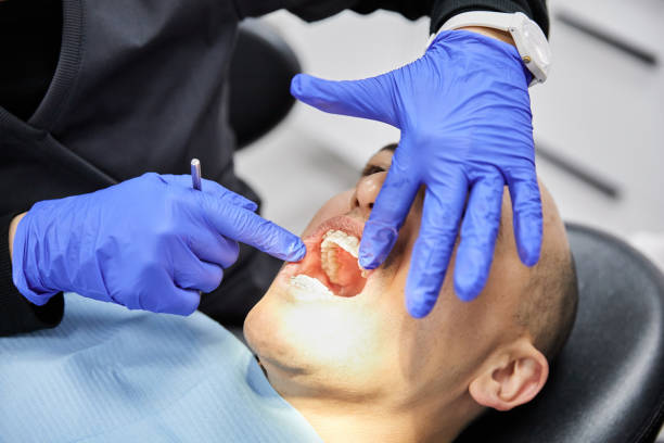 Best Dental Abscess Treatment in Lynwood, IL